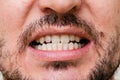 Closeup young man with beautiful smile. Teeth whitening, teeth straightening, fresh breath Royalty Free Stock Photo