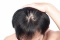 Closeup Young man serious hair loss and grey hair problem with white backgroun for health care medical and shampoo product concept