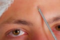 Closeup young mans face preparing for facial cosmetic treatment, doctor using metal tool with loop at end to measure Royalty Free Stock Photo