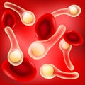 Red blood cells and bacteria Clostridium tetani with spores on r Royalty Free Stock Photo