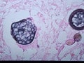 Coccidioides imitis rupturing spherule with endospores on GMS stain