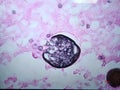 Coccidioides imitis rupturing spherule with endospores on GMS stain