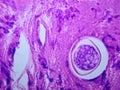 Coccidioides imitis spherule on H and E pathology specimen