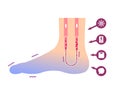 Cold foot blood circulation illustration sensitivity to cold, cold toes / No text