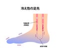 Cold foot blood circulation illustration sensitivity to cold, cold toes / Japanese