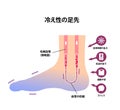 Cold foot blood circulation illustration sensitivity to cold, cold toes / Japanese