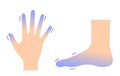 Cold hand and foot / blood circulation illustration sensitivity to cold