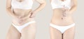 Collage of 2 female figures in white underwear. Woman Before and after losing weight. Overweight woman and slim woman