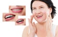 Collage of healthy smiling people. Beautiful middle age woman with white veneers and perfect smile. Tooth care dental medicine.