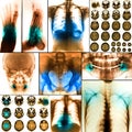 Collage of human X-rays photo