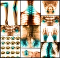 Collage of human X-rays photo