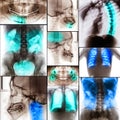 Collage of human X-rays photo