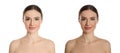 Collage with photos of beautiful young woman before and after indoor tanning on white background. Banner design Royalty Free Stock Photo