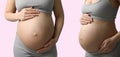 Collage with photos of pregnant woman touching her belly on beige background, closeup. Banner design Royalty Free Stock Photo