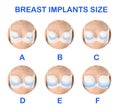 Collage with photos of woman demonstrating implant sizes for breast on white background, closeup