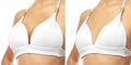 Collage with photos of young woman before and after breast size correction on white background, closeup. Banner design Royalty Free Stock Photo