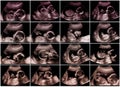 Collage of 16 ultrasonography fetus pictures