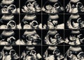 Collage of 16 ultrasonography fetus pictures