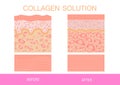 Collagen ,Protection Skin vector Royalty Free Stock Photo