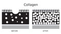 Collagen ,skin vector