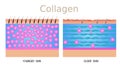 Collagen ,skin vector