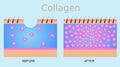 Collagen ,skin vector Royalty Free Stock Photo
