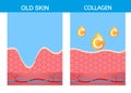 Collagen ,skin vector strabismus anatomy medical