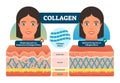 Collagen vector illustration. Medical and anatomical labeled scheme with fibers, epidermis, hypodermis and muscle. Anatomy diagram