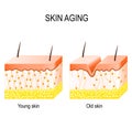 collagen in younger and older skin. collagen in younger and older skin.