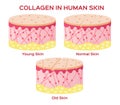 Collagen in younger skin and aging version Royalty Free Stock Photo