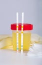 Collection cup with urine test on a table of a lab technician. Royalty Free Stock Photo
