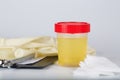 Collection cup with urine test on a table of a lab technician.