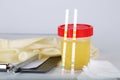 Collection cup with urine test on a table of a lab technician.