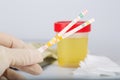 Collection cup with urine test on a table of a lab technician.