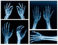 Collection hand x-ray