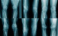 Collection leg x-ray Royalty Free Stock Photo