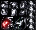 Collection of MRI heart or Cardiac MRI Royalty Free Stock Photo