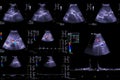 Collection of Ultrasound upper abdomen.