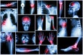 Collection X-ray multiple disease Royalty Free Stock Photo