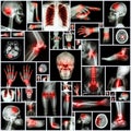 Collection X-ray multiple organ and arthritis at multiple joint (Rheumatoid,Gout)