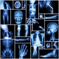 Collection X-ray Royalty Free Stock Photo