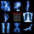 Collection of X-ray part of human