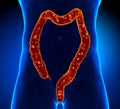 Colon Anatomy - pain Royalty Free Stock Photo