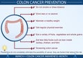 Colon Cancer Prevention Infographic Vector Illustration