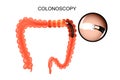 The colon, colonoscopy Royalty Free Stock Photo