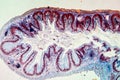 Colon with villi tissue