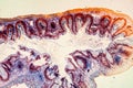 Colon with villi tissue