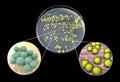 Colonies of bacteria grown from human skin