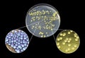 Colonies of bacteria grown from human skin