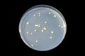 Colonies of bacteria Micrococcus luteus on Tryptic Soy Agar